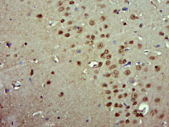 Pygopus 2 Rabbit Polyclonal Antibody