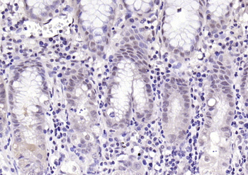 Phospho-Parkin (Ser131) Rabbit Polyclonal Antibody