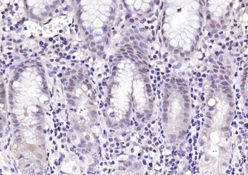 Parkin (phospho-Ser131) antibody