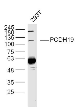 PCDH19 Rabbit Polyclonal Antibody