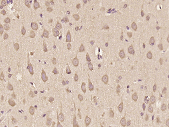 PPP2R2D Rabbit Polyclonal Antibody