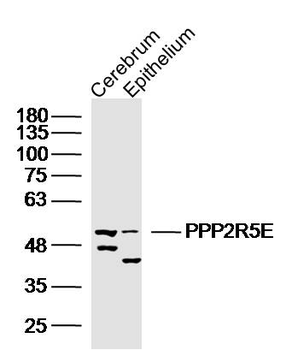 PPP2R5E Rabbit Polyclonal Antibody
