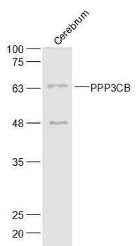 PPP3CB Rabbit Polyclonal Antibody