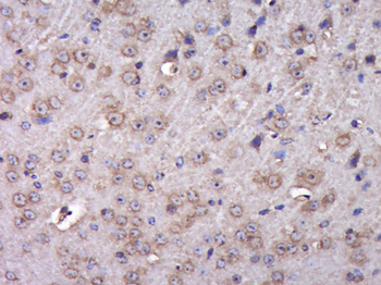 PABP2 Rabbit Polyclonal Antibody