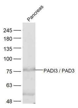 PADI3 / PAD3 Rabbit Polyclonal Antibody
