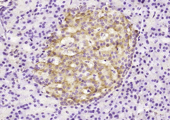 PAFAH2 Rabbit Polyclonal Antibody