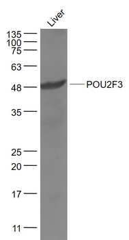 POU2F3 Rabbit Polyclonal Antibody