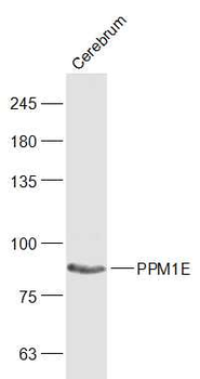 PPM1E Rabbit Polyclonal Antibody