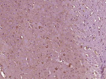 P5CS Rabbit Polyclonal Antibody
