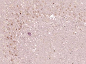 P66 beta/GATAD2B Rabbit Polyclonal Antibody