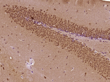 PRCC/Papillary renal cell carcinoma Rabbit Polyclonal Antibody
