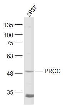 PRCC/Papillary renal cell carcinoma Rabbit Polyclonal Antibody