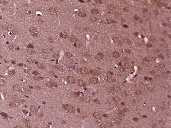 PEX10 Rabbit Polyclonal Antibody