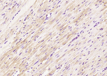 PFDN1 Rabbit Polyclonal Antibody