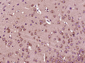 PFKFB3/PFK2 Rabbit Polyclonal Antibody