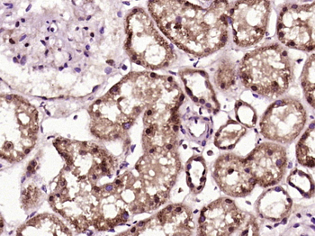 PKD1L2 Rabbit Polyclonal Antibody