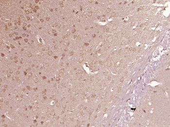 PLCD1/NDNC3 Rabbit Polyclonal Antibody