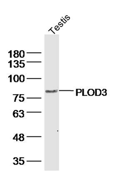PLOD3 Rabbit Polyclonal Antibody