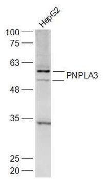 PNPLA3 Rabbit Polyclonal Antibody