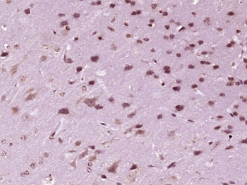 PNRC2 Rabbit Polyclonal Antibody
