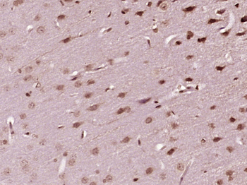 PNRC2 Rabbit Polyclonal Antibody
