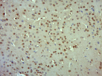 R3HDM2 Rabbit Polyclonal Antibody