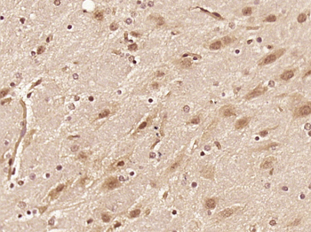 RAD26L/C9orf102 Rabbit Polyclonal Antibody