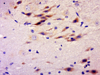 RASGRP4 Rabbit Polyclonal Antibody