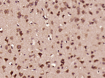 RBM14 Rabbit Polyclonal Antibody