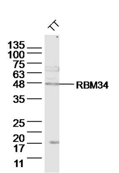RBM34 Rabbit Polyclonal Antibody