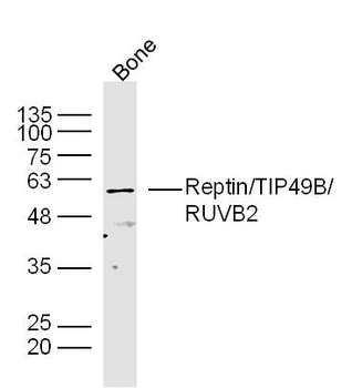 Reptin/TIP49B/RUVB2 Rabbit Polyclonal Antibody