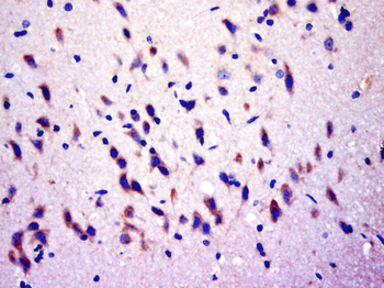 RGS17 Rabbit Polyclonal Antibody