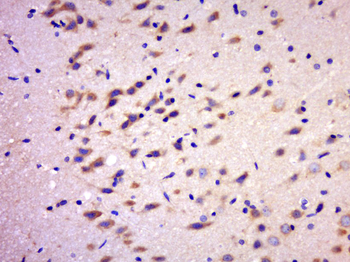 RGS17 Rabbit Polyclonal Antibody