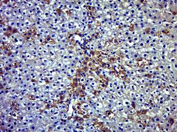 PARP14 Rabbit Polyclonal Antibody