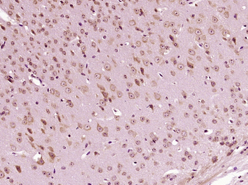 SAP30 Rabbit Polyclonal Antibody