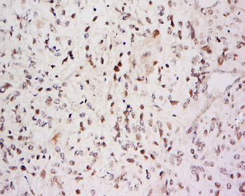 SARA Rabbit Polyclonal Antibody