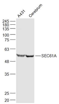 SEC61A Rabbit Polyclonal Antibody