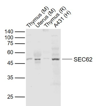 SEC62 Rabbit Polyclonal Antibody