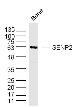 SENP2 Rabbit Polyclonal Antibody