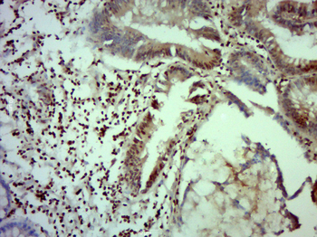 SFPQ Rabbit Polyclonal Antibody