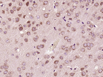 SH3BP1 Rabbit Polyclonal Antibody