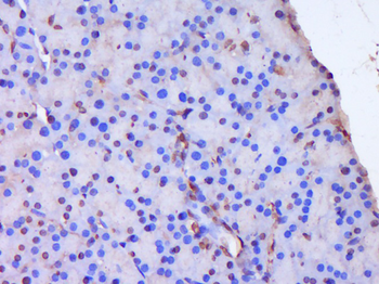 SH3BP4 Rabbit Polyclonal Antibody