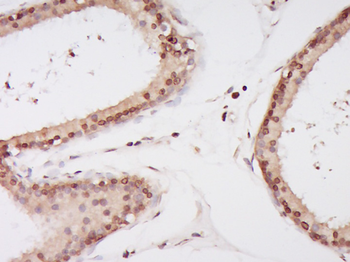 SH3BP4 Rabbit Polyclonal Antibody