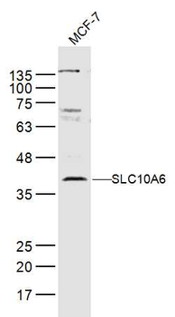 SLC10A6 Rabbit Polyclonal Antibody
