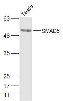 SMAD5 Rabbit Polyclonal Antibody