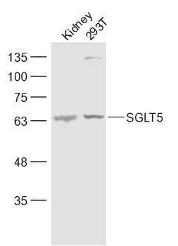 SLC5A10/SGLT5 Rabbit Polyclonal Antibody