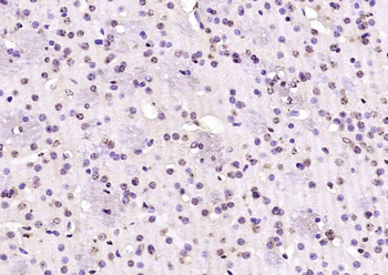SLX4/BTBD12 Rabbit Polyclonal Antibody