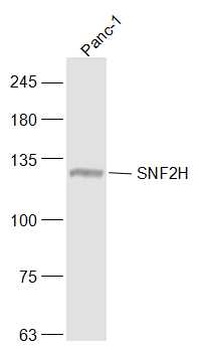 SNF2H antibody
