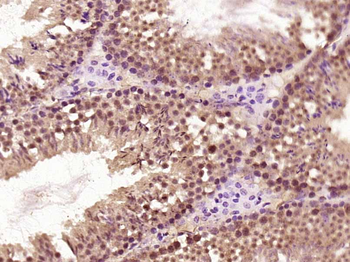 SNRNP200 Rabbit Polyclonal Antibody