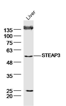 STEAP3 Rabbit Polyclonal Antibody
